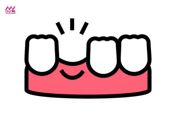 kinh nghiệm trồng răng sứ