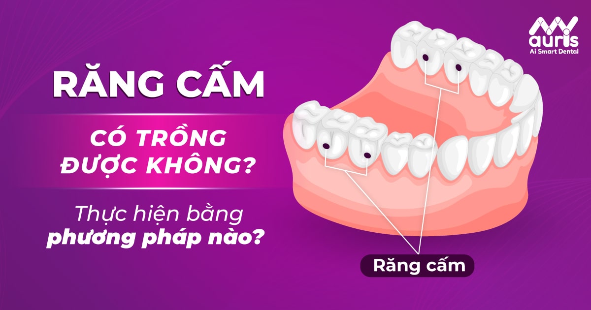 răng cấm có trồng được không