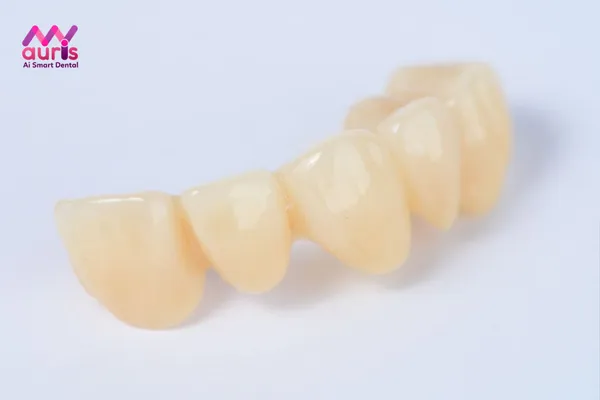 Nhược điểm của răng sứ Full Zirconia