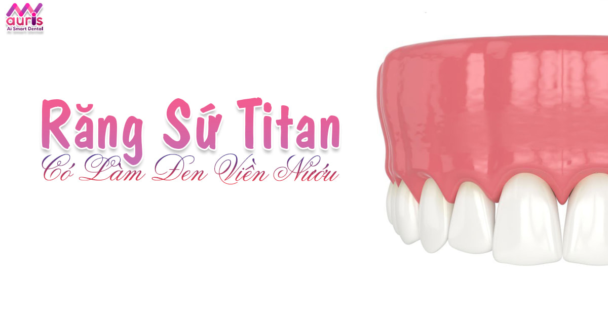 răng sứ titan có làm đen viền nướu