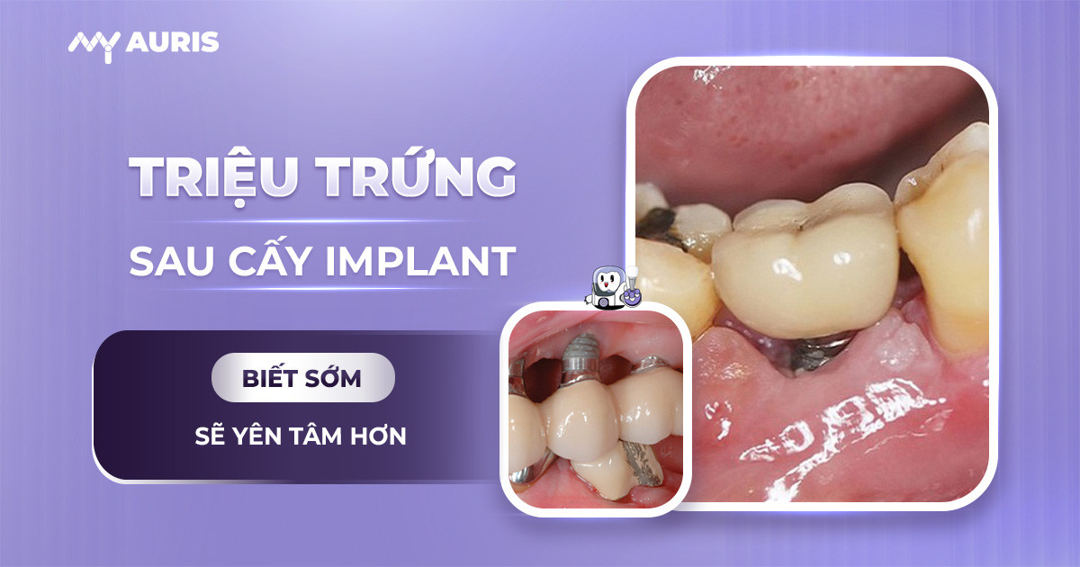 triệu chứng sau cấy implant,chảy máu sau khi cắm implant,triệu chứng sau khi cấy implant