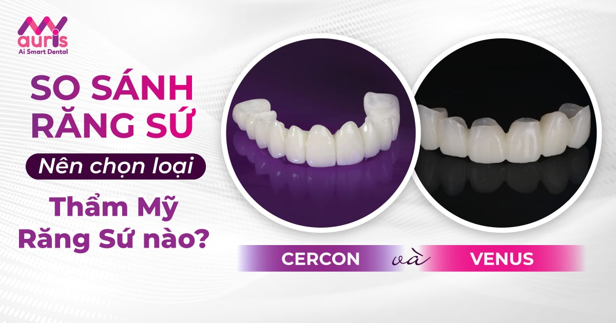 so sánh răng sứ cercon và venus