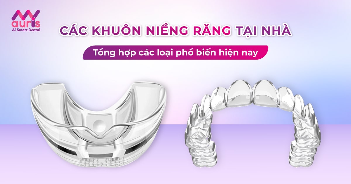 Tổng hợp các khuôn niềng răng tại nhà phổ biến hiện nay