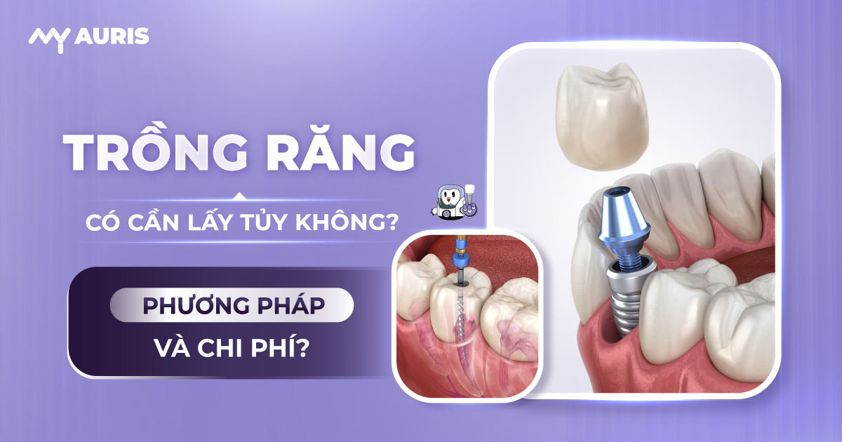 trồng răng có cần lấy tủy không,trồng răng sứ có phải lấy tủy