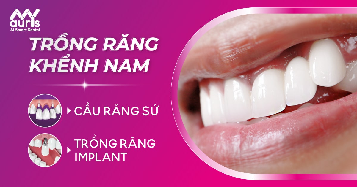 Trồng răng khểnh nam bằng phương pháp nào tốt?