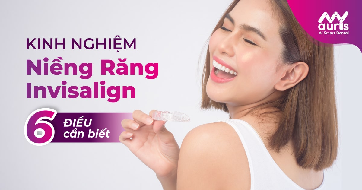 kinh nghiệm niềng răng invisalign