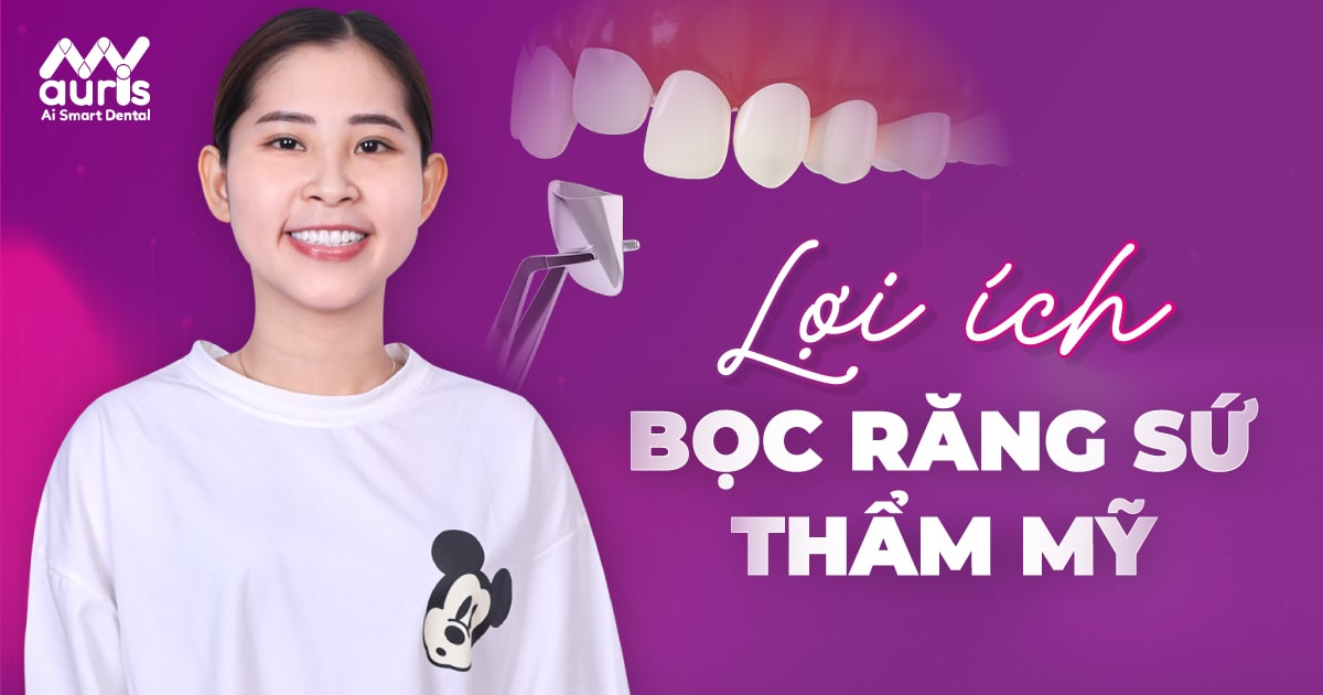 bọc răng sứ thẩm mỹ có tốt không