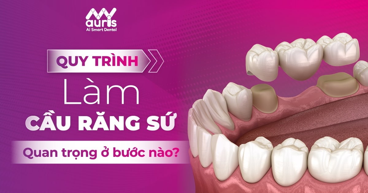 quy trình làm cầu răng sứ