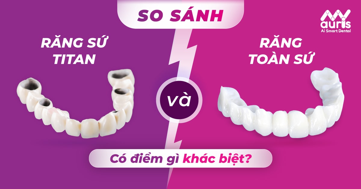 so sánh răng sứ titan và răng toàn sứ