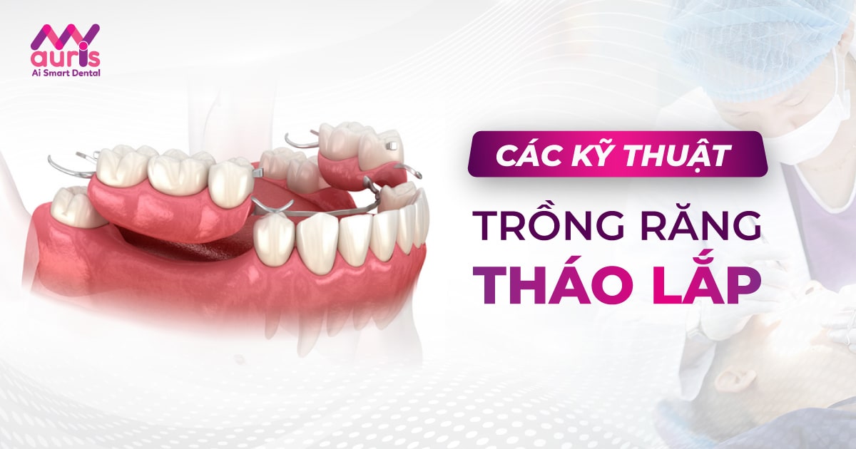 trồng răng cửa tháo lắp