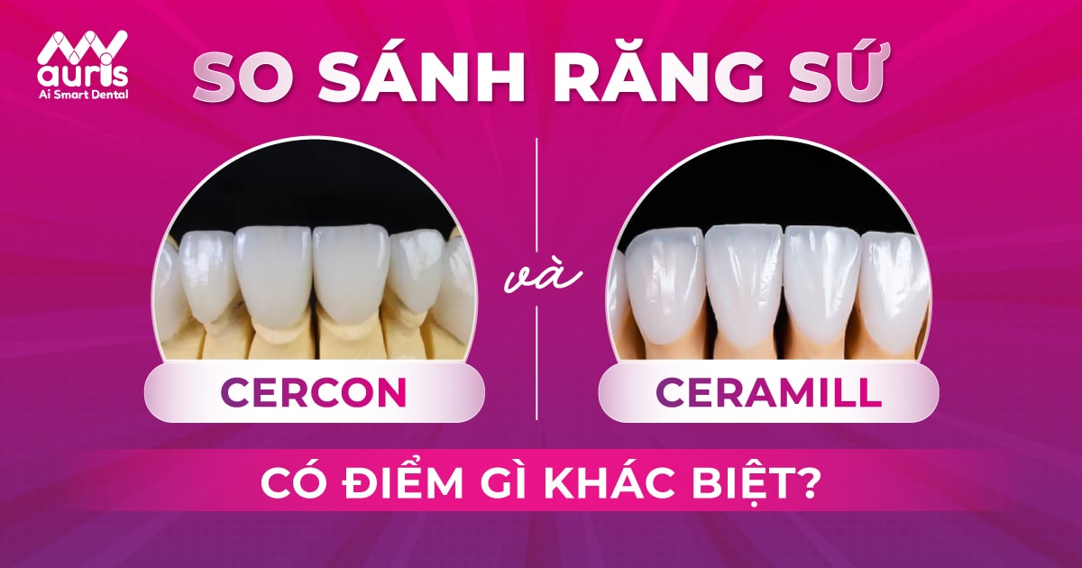 so sánh răng sứ cercon và ceramill