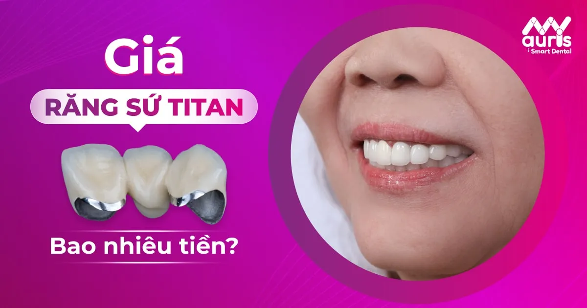 răng sứ titan giá bao nhiêu tiền