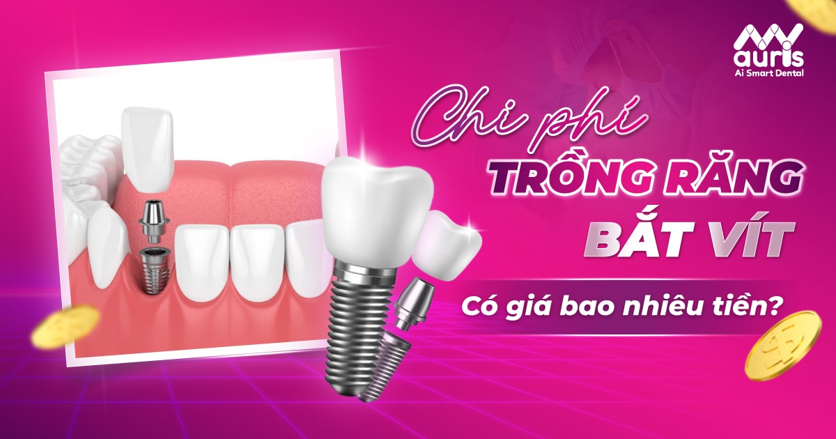 trồng răng bắt vít giá bao nhiêu