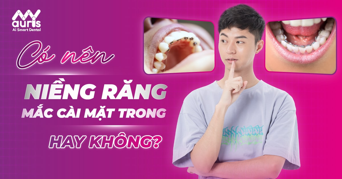 niềng răng mặt trong giá rẻ