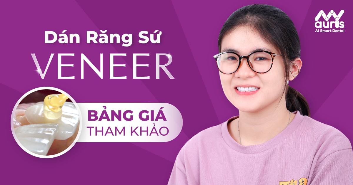 Bảng giá dán răng sứ Veneer và yếu tố ảnh hưởng