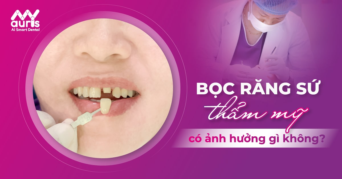 bọc răng sứ thẩm mỹ có ảnh hưởng gì không