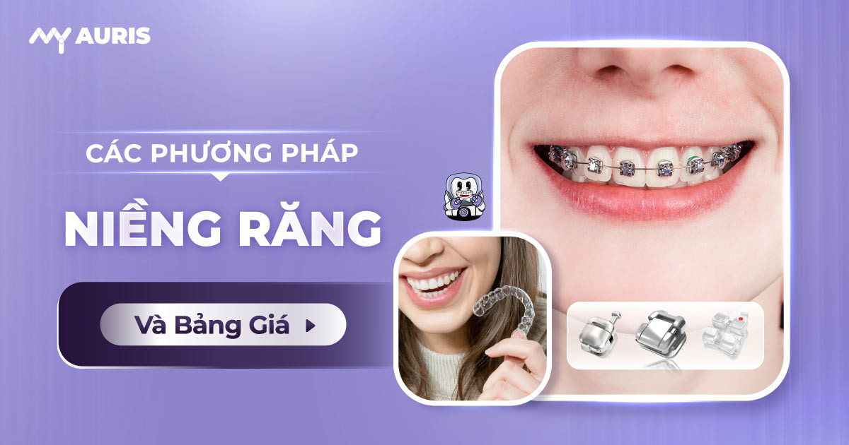 các phương pháp niềng răng