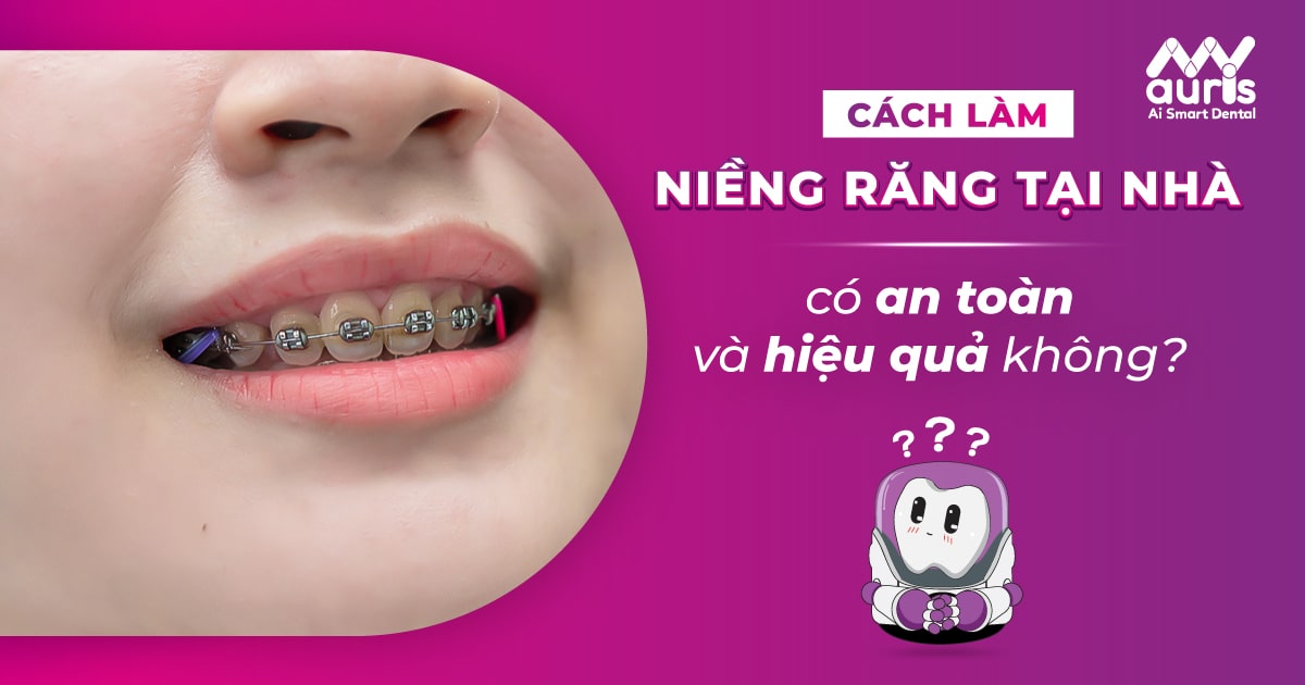 cách làm niềng răng tại nhà