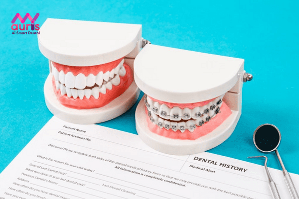 Những yếu tố làm ảnh hưởng đến chi phí điều trị niềng răng