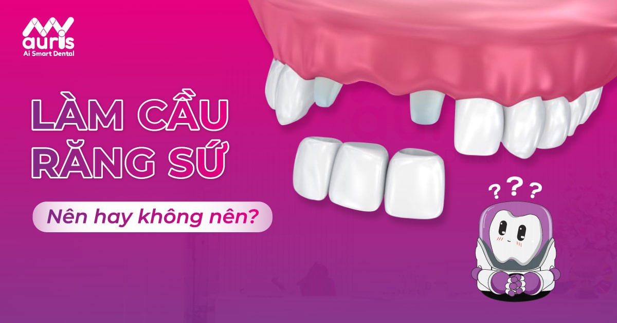 Có nên làm cầu răng sứ không và cần lưu ý gì?