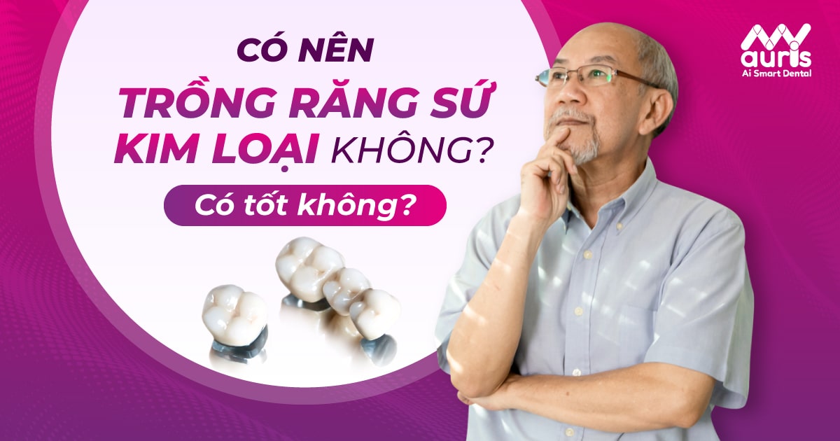 có nên trồng răng sứ kim loại không