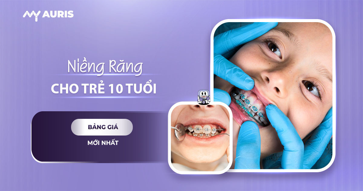 giá niềng răng cho trẻ 10 tuổi