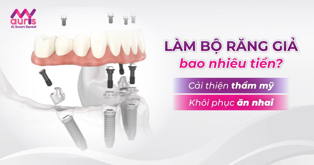 làm bộ răng giả bao nhiêu tiền