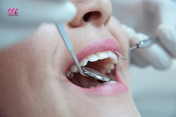  cách làm sạch răng sứ thẩm mỹ