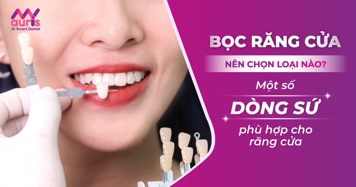 bọc răng cửa nên chọn loại nào