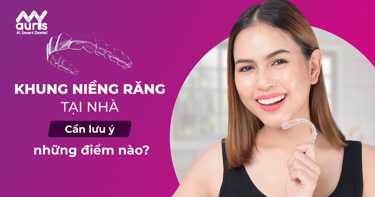 Khung niềng răng tại nhà gồm những loại nào?