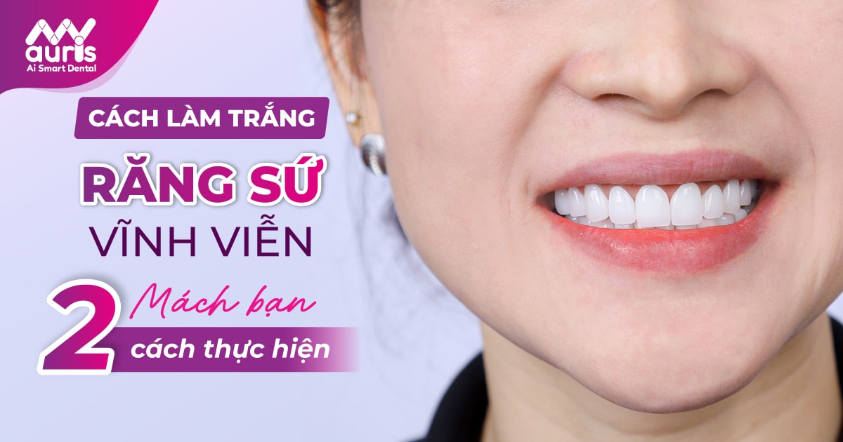 cách làm trắng răng sứ vĩnh viễn