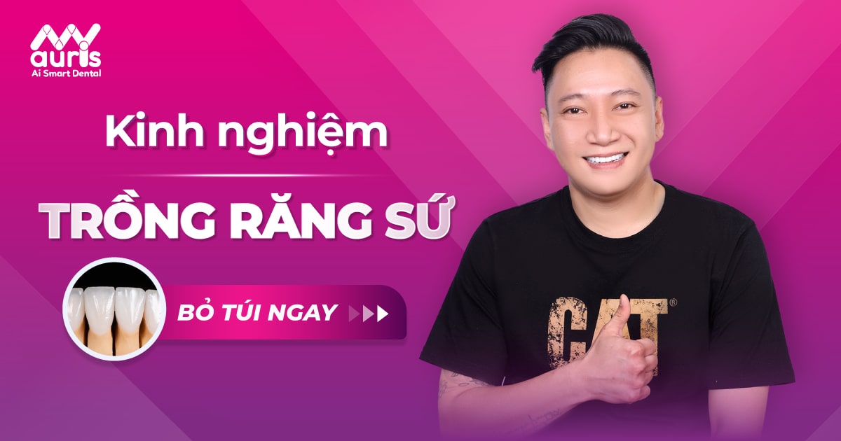 kinh nghiệm trồng răng sứ