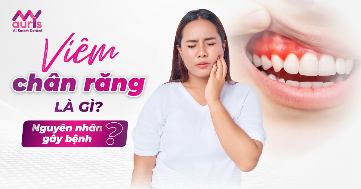 Viêm chân răng là gì? 2 nguyên nhân chính gây bệnh