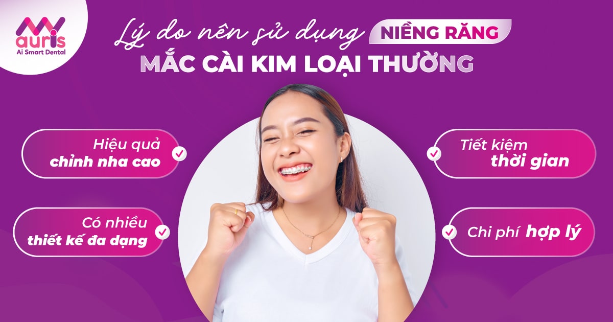 Niềng răng mắc cài kim loại thường và điểm cần biết