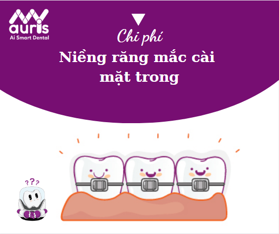 niềng răng mặt trong giá rẻ