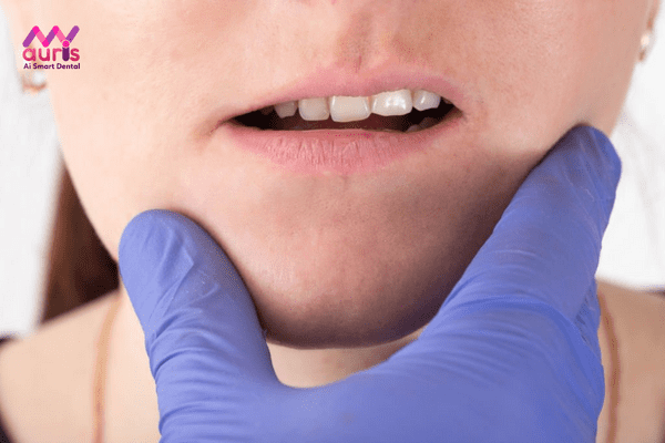 Răng móm là răng gì?