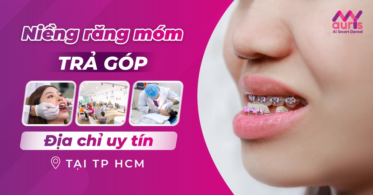 niềng răng móm trả góp