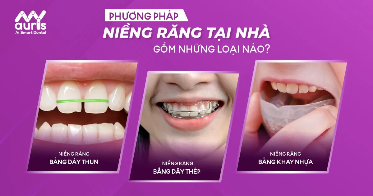 Phương pháp niềng răng tại nhà phổ biến hiện nay