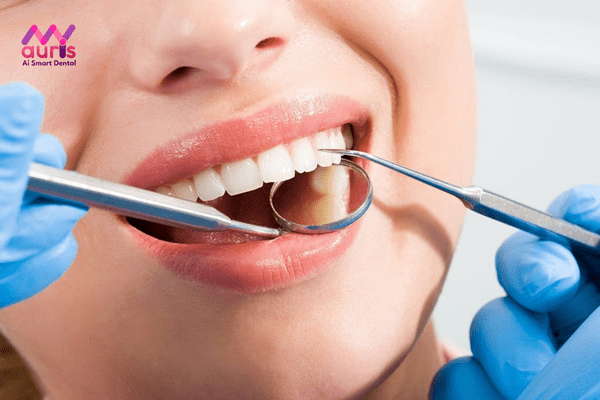 Đắp răng khểnh bằng chất liệu trám Composite