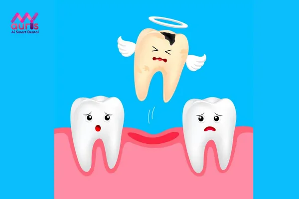Những hậu quả sẽ gặp khi mất răng cấm