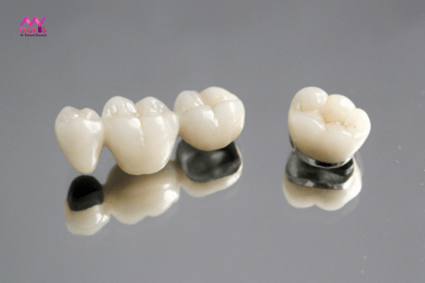 răng sứ niken