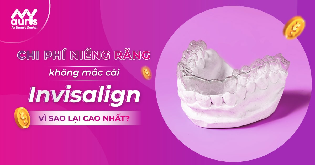 Tại sao chi phí niềng răng không mắc cài Invisalign cao?