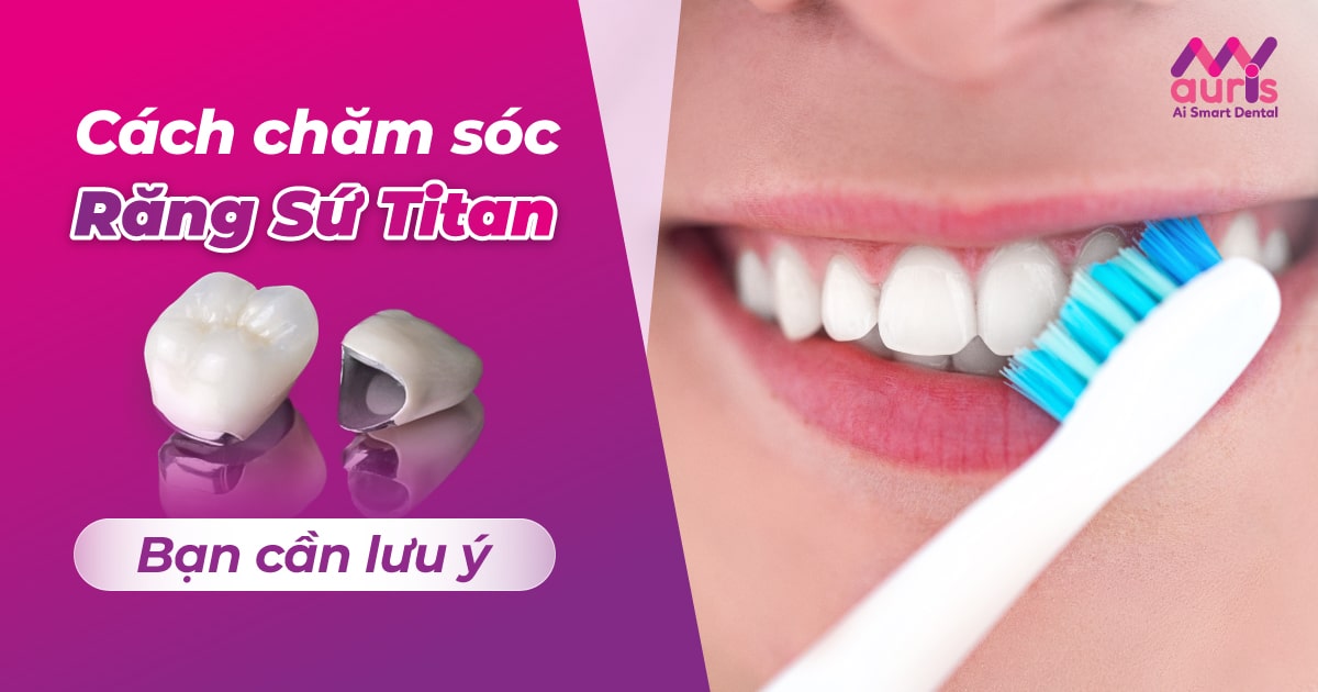 Tìm hiểu cách chăm sóc răng sứ Titan bạn cần lưu ý