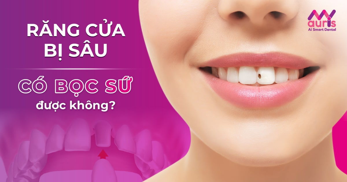 Giải đáp răng cửa bị sâu có bọc sứ được không?