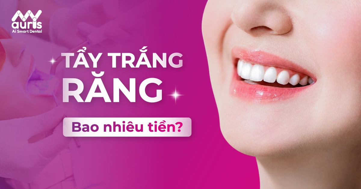 Tìm hiểu tẩy trắng răng giá bao nhiêu tiền?