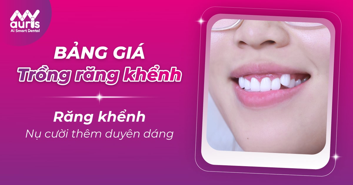 bảng giá trồng răng khểnh