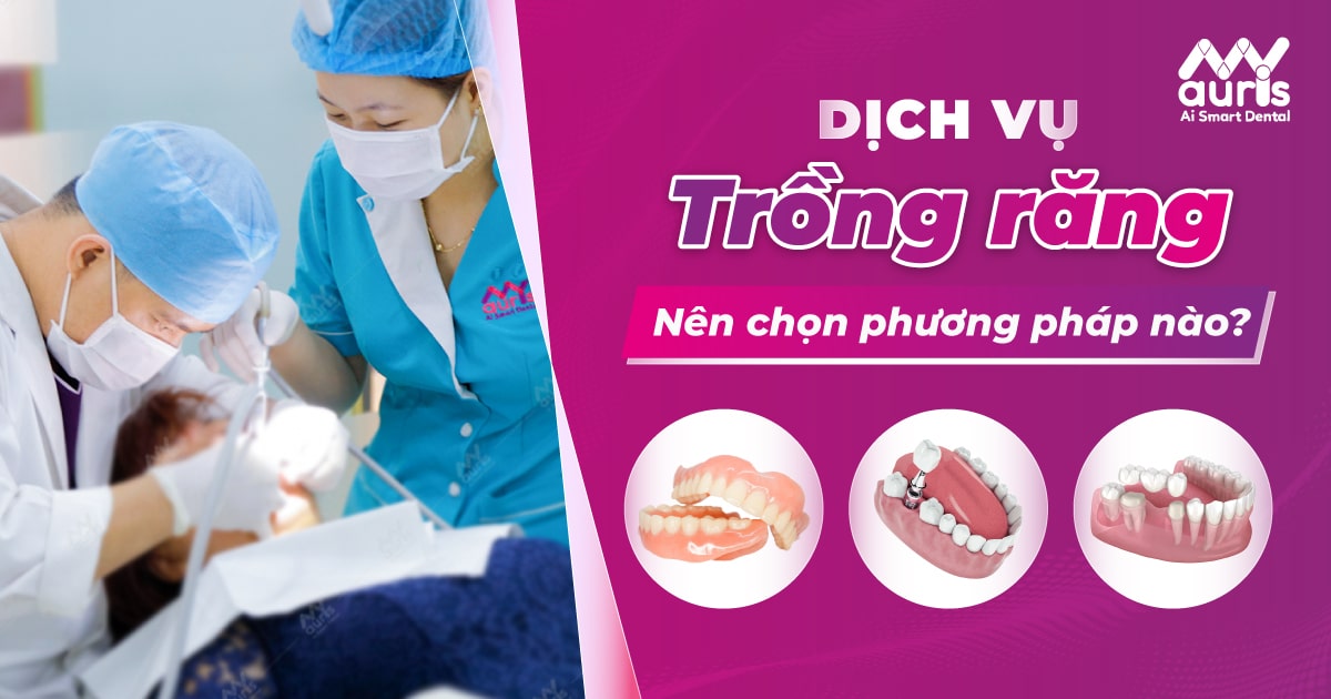 dịch vụ trồng răng