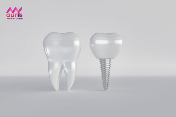 Cấy ghép răng Implant