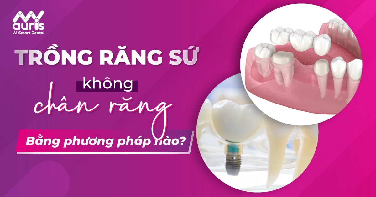 trồng răng sứ không có chân răng