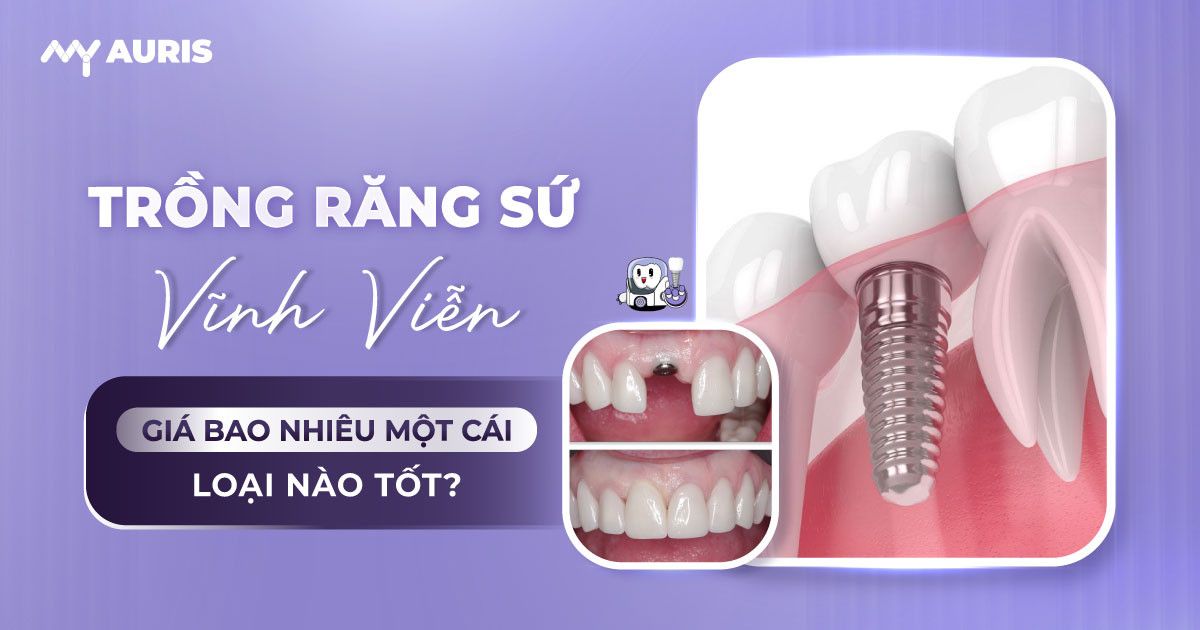 trồng răng sứ vĩnh viễn,trồng răng sứ bao nhiêu,trồng răng sứ bao nhiêu một cái,trồng răng sứ bao nhiêu tiền một cái